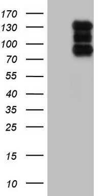 ZEB1 Antibody