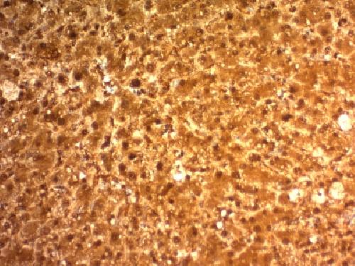 ARG1 Antibody