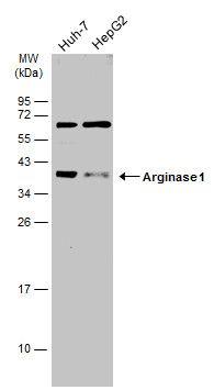 Arginase 1 antibody