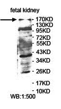 ARHGAP5 Rabbit Polyclonal Antibody