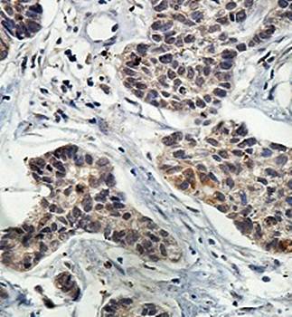 ARHGEF16 Rabbit Polyclonal Antibody