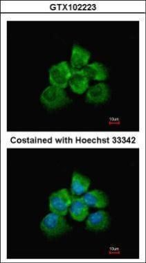 ARHGEF18 Rabbit Polyclonal Antibody