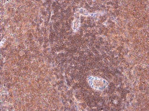 ARHGEF18 Rabbit Polyclonal Antibody