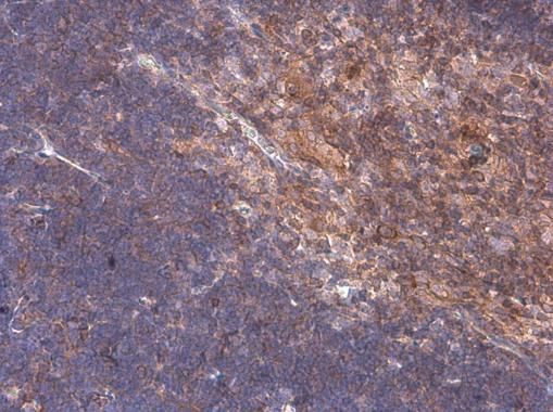 ARHGEF18 Rabbit Polyclonal Antibody
