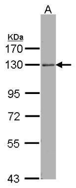 ARHGEF18 Rabbit Polyclonal Antibody