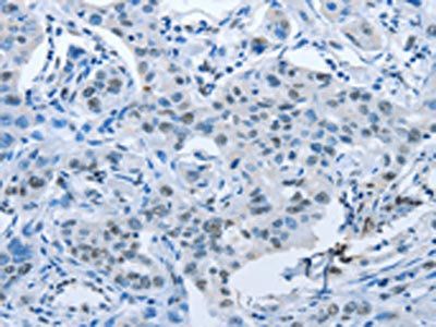 ARHGEF2 Antibody