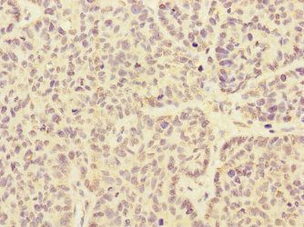 ARHGEF3 Antibody
