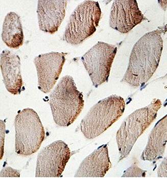 ARHGEF3 Rabbit Polyclonal Antibody
