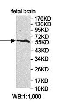 ARHGEF3 Rabbit Polyclonal Antibody