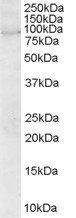 Goat anti-ARHGEF4 Antibody