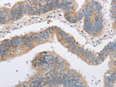 ARHGEF9 Antibody