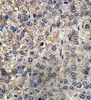 ARHGEF9 Rabbit Polyclonal Antibody