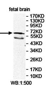 ARHGEF9 Rabbit Polyclonal Antibody