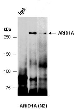 ARID1A (N2) Antibody, Rabbit Polyclonal