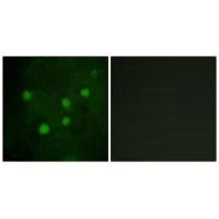 ARID1B Antibody