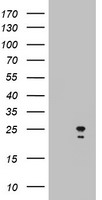 ARL2BP Antibody