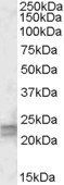 ARL4D Antibody