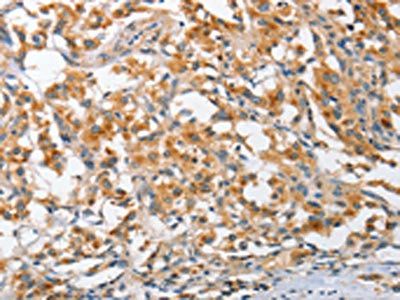 ARL8A Antibody