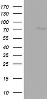 ARMETL1 Antibody