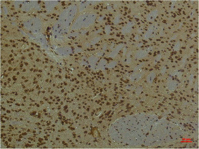 ARNT Antibody