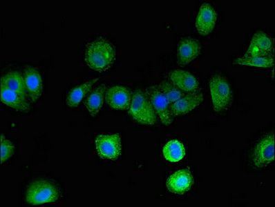 ARRB2 Antibody