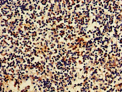 ARRB2 Antibody
