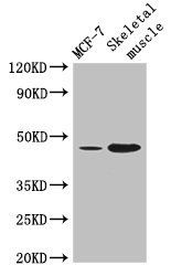 ARRDC3 Antibody