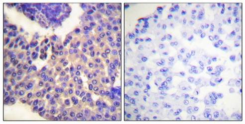 Arrestin 1 (Phospho-Ser412) Antibody