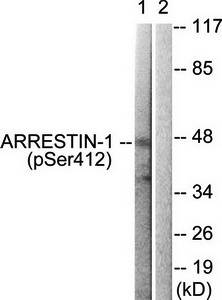 Arrestin 1 (Phospho-Ser412) Antibody