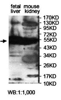 ARSA Rabbit Polyclonal Antibody