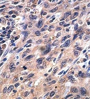 ARSA Rabbit Polyclonal Antibody