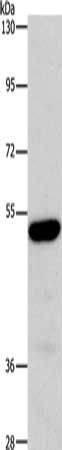 ARSB Antibody