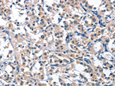 ASB2 Antibody
