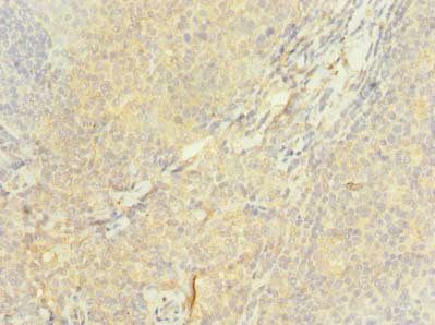 ASCC1 Antibody