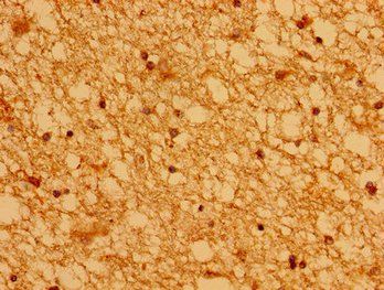 ASCL1 Antibody