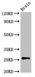 ASCL1 Antibody