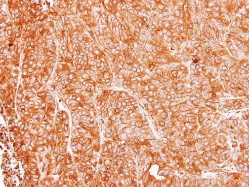 ASL Rabbit Polyclonal Antibody