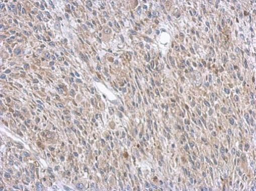 ASL Rabbit Polyclonal Antibody