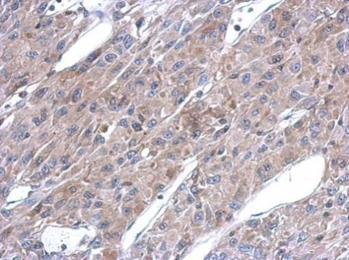 ASL Rabbit Polyclonal Antibody