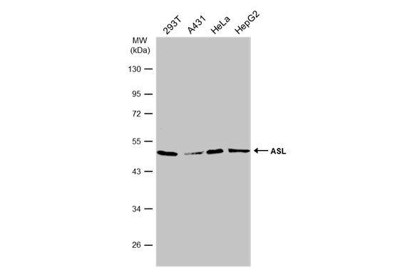 ASL Rabbit Polyclonal Antibody
