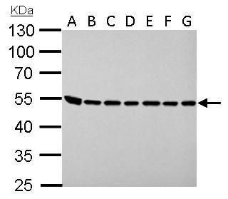 ASL Rabbit Polyclonal Antibody