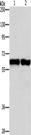ASNS Antibody