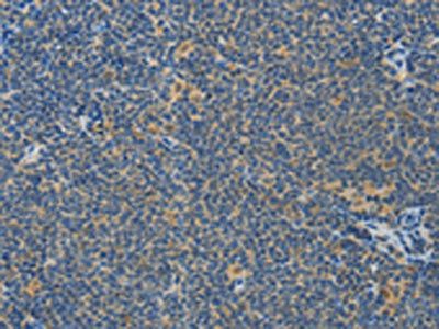 ASPA Antibody