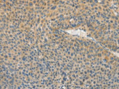 ASPA Antibody