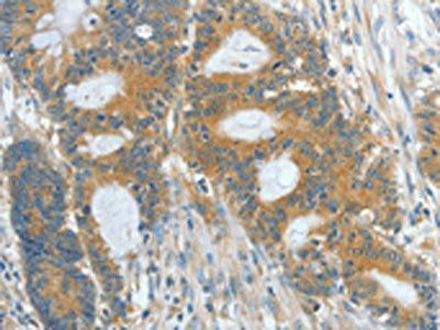 ASPA Antibody