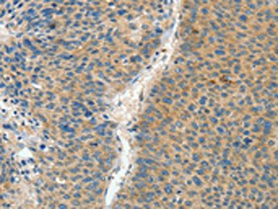 ASPA Antibody