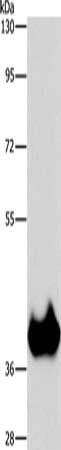 ASPA Antibody