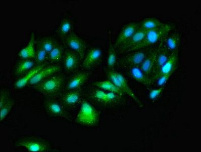 GOT1 Antibody