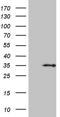 ASS1 Antibody