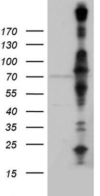 ASS1 Antibody